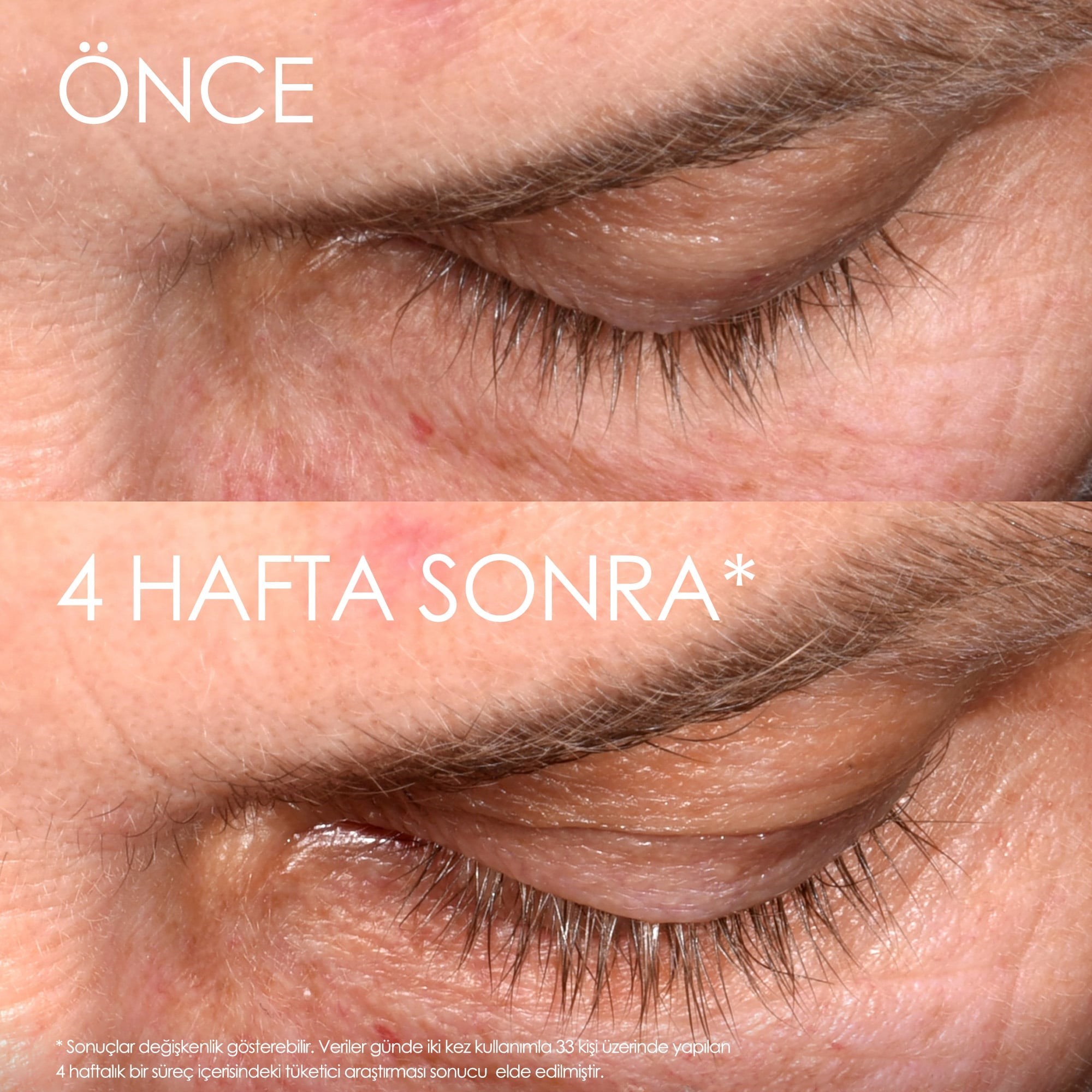 GROWTH YOUR LASH DUO 7