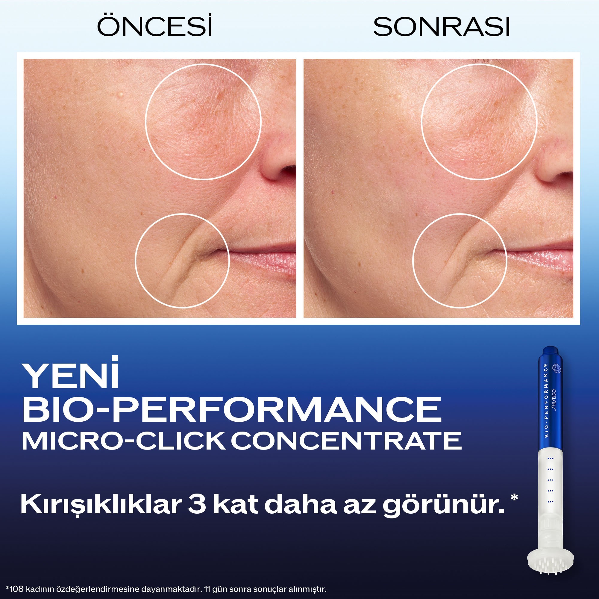 BIO-PERFORMANCE VISIBLE LIFT & FULL EXPANSION SET 3